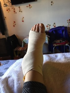 1.1487498868.it-s-just-a-sprain